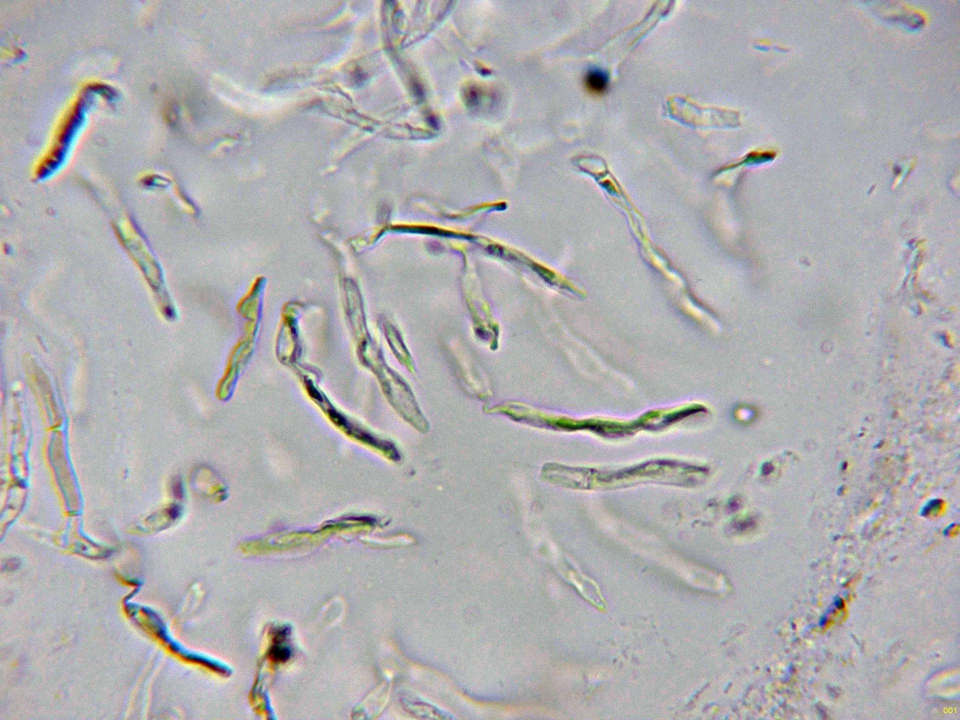 Microscopía de Russula integra - 10 - Dermatocistidios agua-001